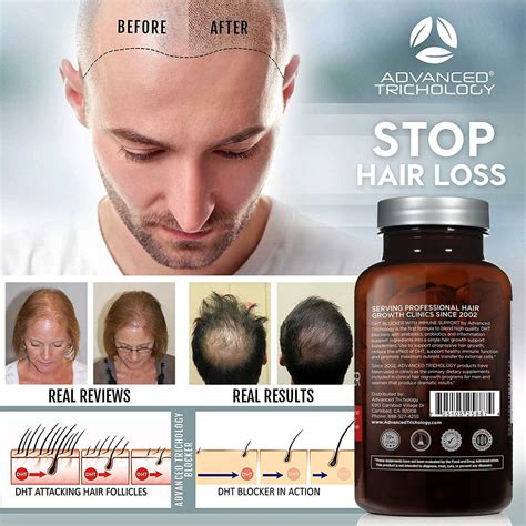 beta blockers hair loss